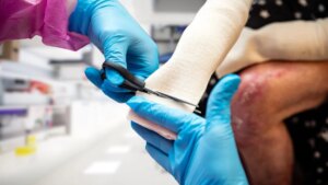 Epidermolysis bullosa or “butterfly disease”: when the skin tears at the slightest friction