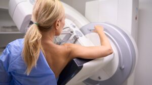Why missing your first breast cancer screening is more dangerous than you think